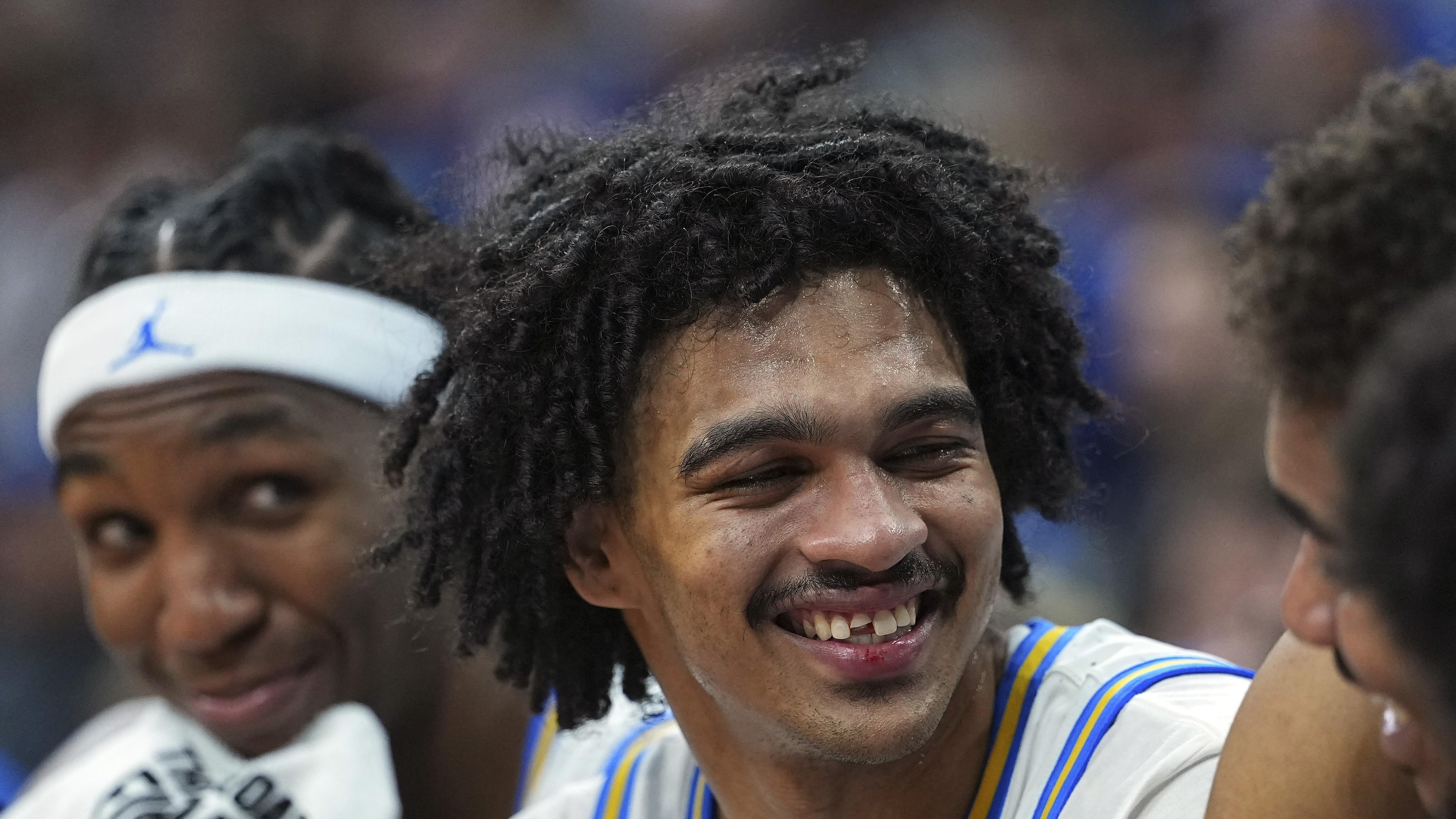 UCLA's Skyy Clark Chips Tooth in Viral Video, Photos During March Madness Win vs. UCF