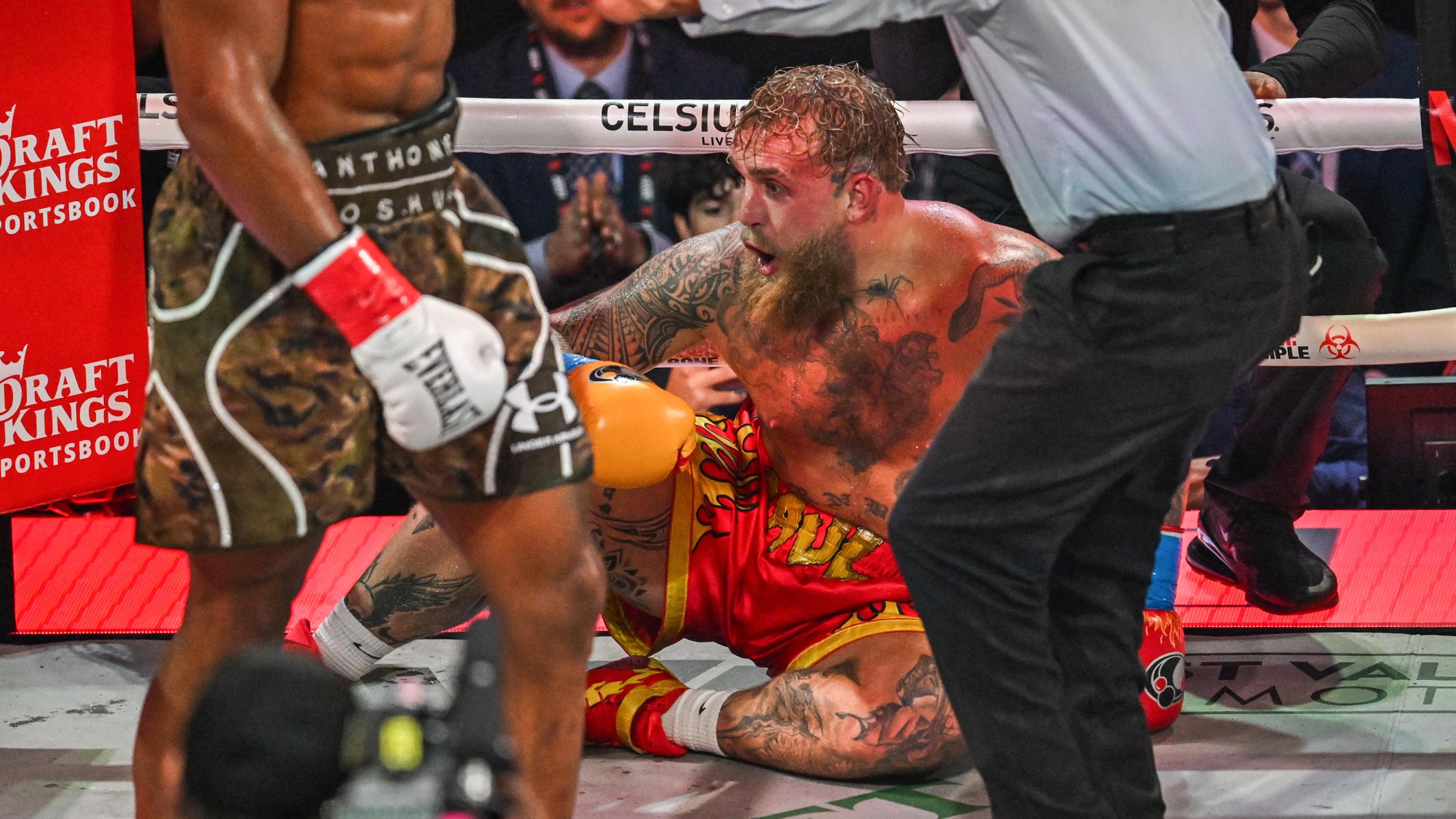 Jake Paul Posts X-Ray Photo of 'Double' Broken Jaw After Being KO'd By Anthony Joshua